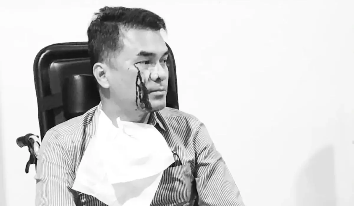 Agama Bro Ron Apa dan Asal Mana? Ini Profil Ronald Aristone Sinaga yang Jadi Korban Penganiayaan di Menteng